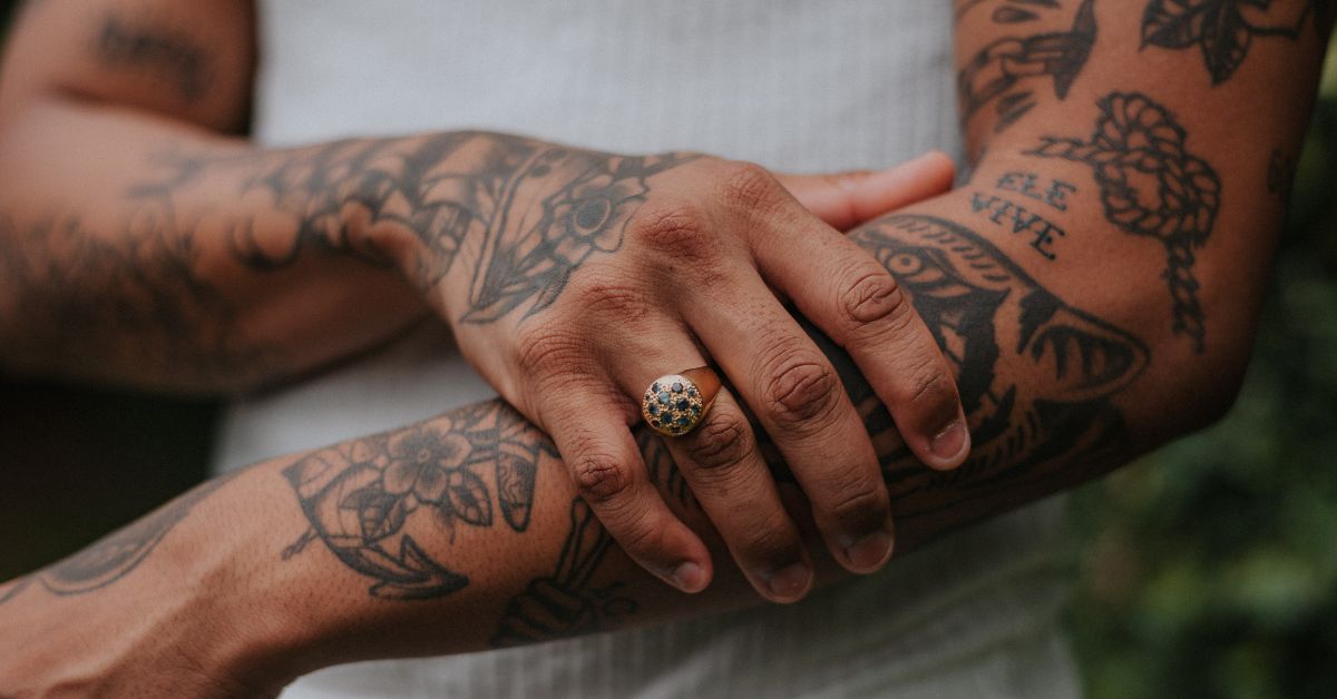 Aplicaciones estéticas del láser Nd-YAG