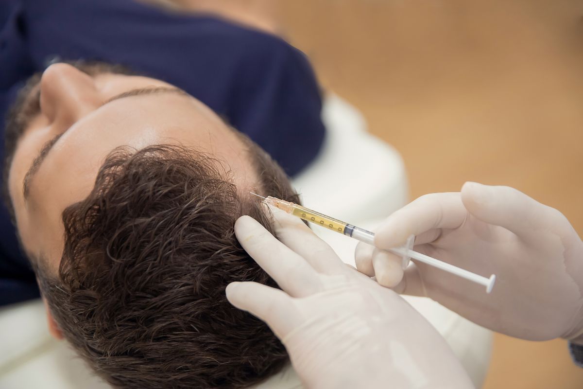 Mesoterapia capilar