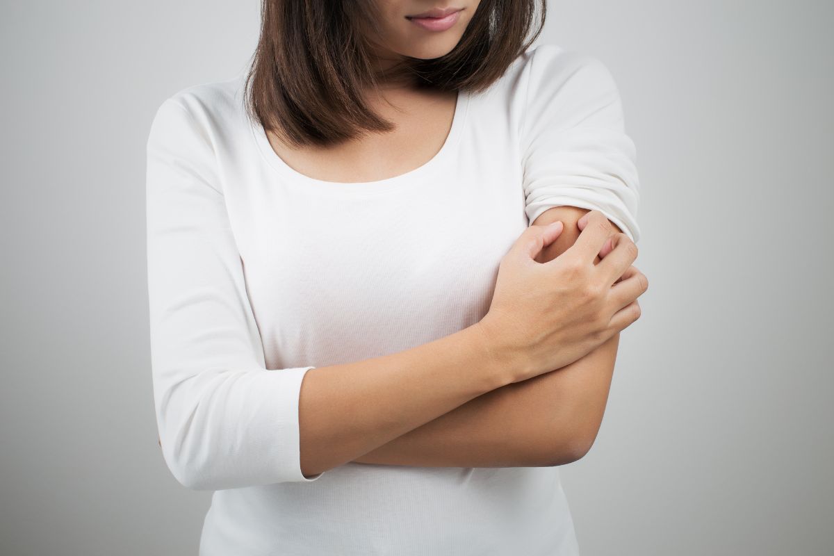 dermatitis atopica