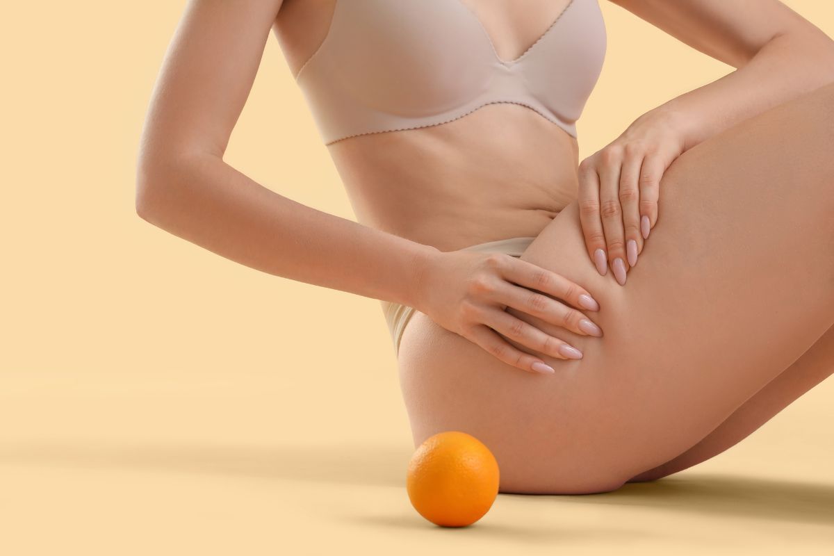 eliminar la piel de naranja