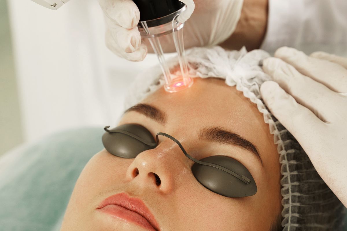 resurfacing facial