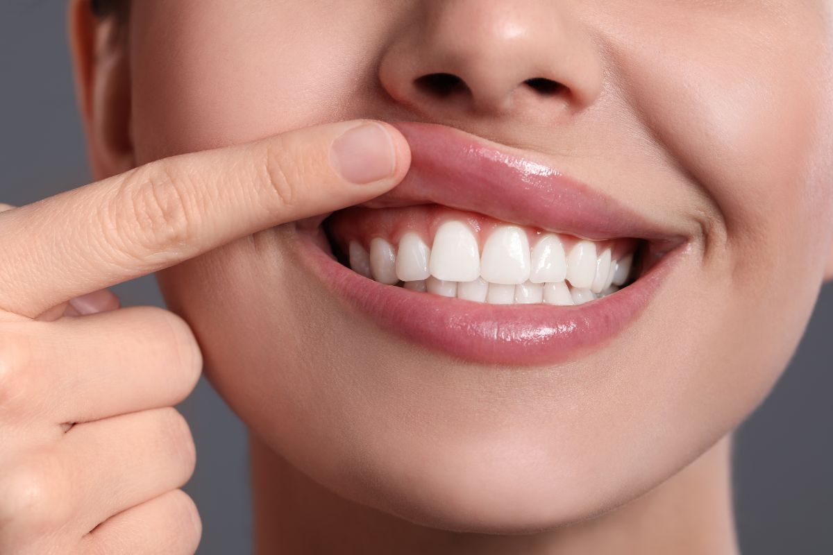 corregir la sonrisa gingival
